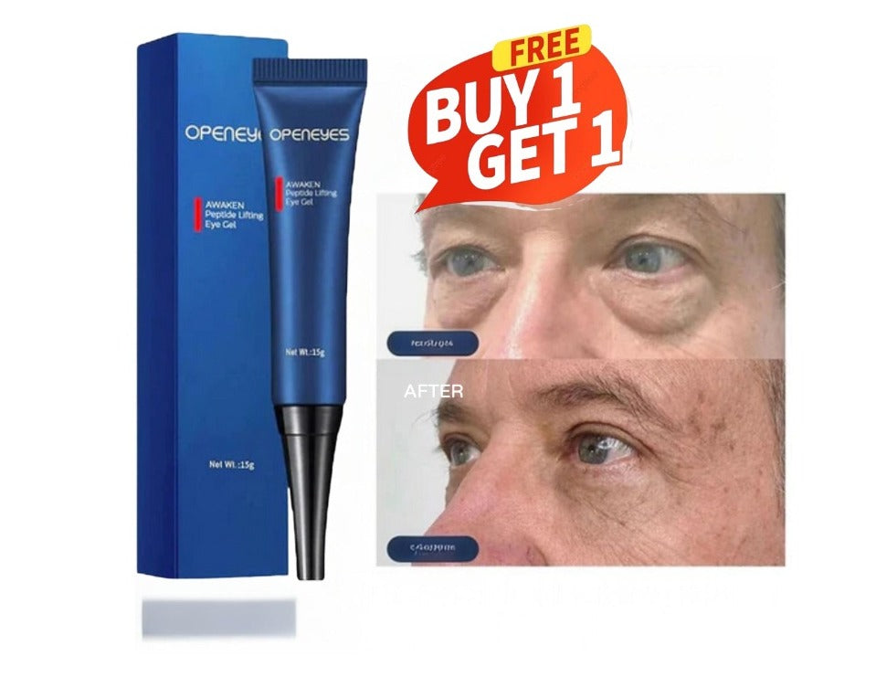 (Buy 1 Get 1 Free) OpenEyes Eye Renewal Cream | Limited Offer